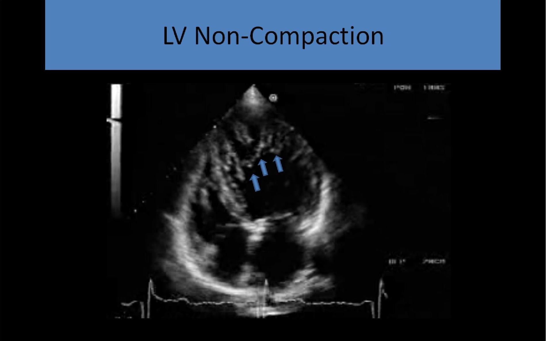 Cardiac Echo Ultrasound Courses