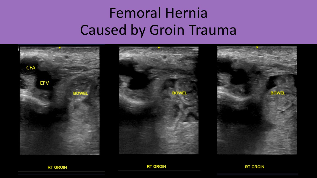 Abdominal ultrasound image 5