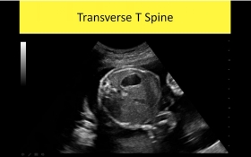 OB GYN Ultrasound Courses