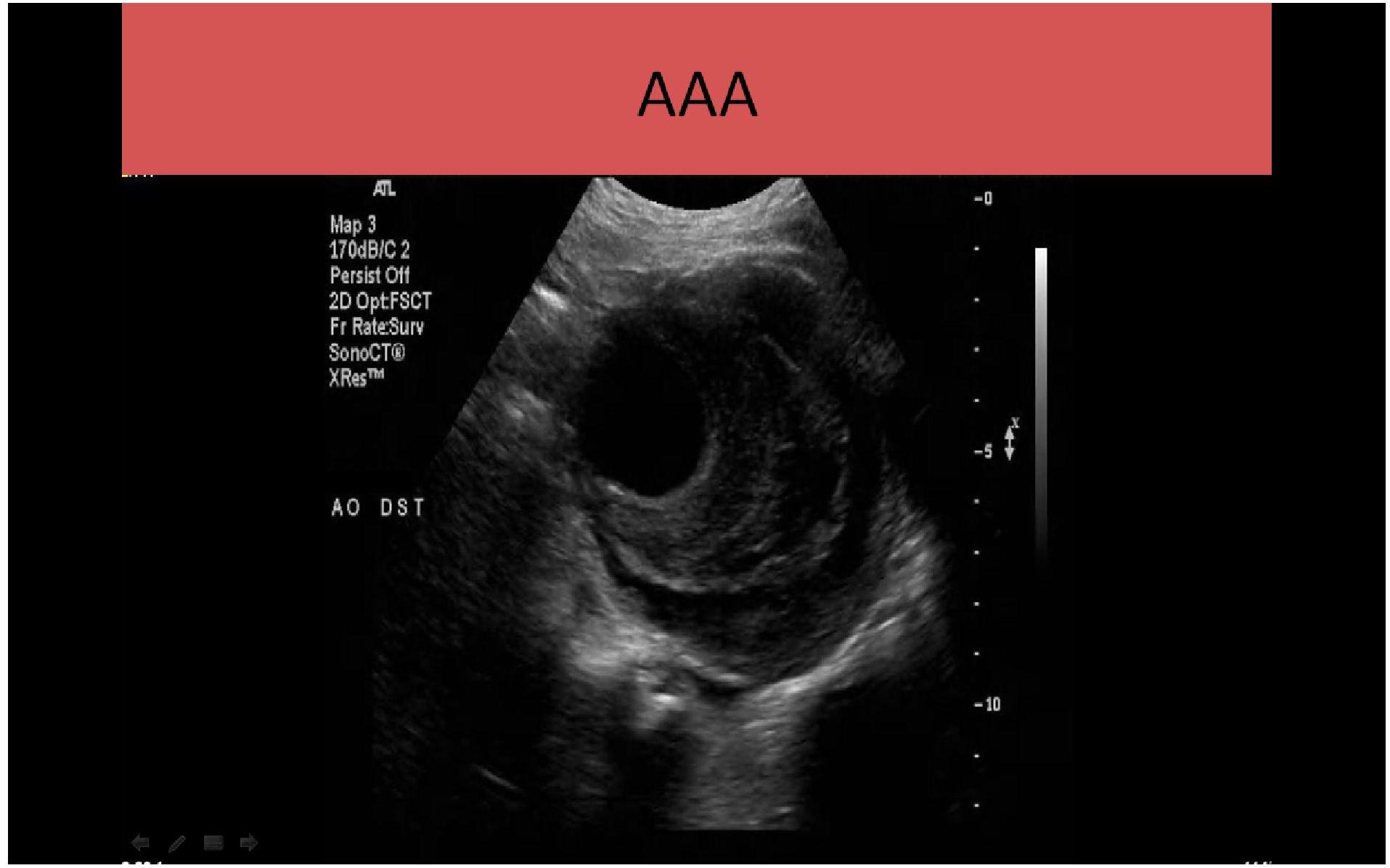 Vascular Ultrasound Courses