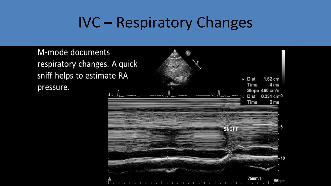 Adult echocardiography image 6