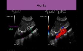Abdominal Ultrasound Courses