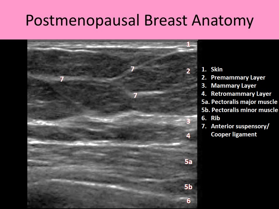 Breast sonography