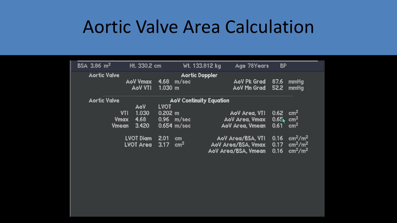 AVA Calculation
