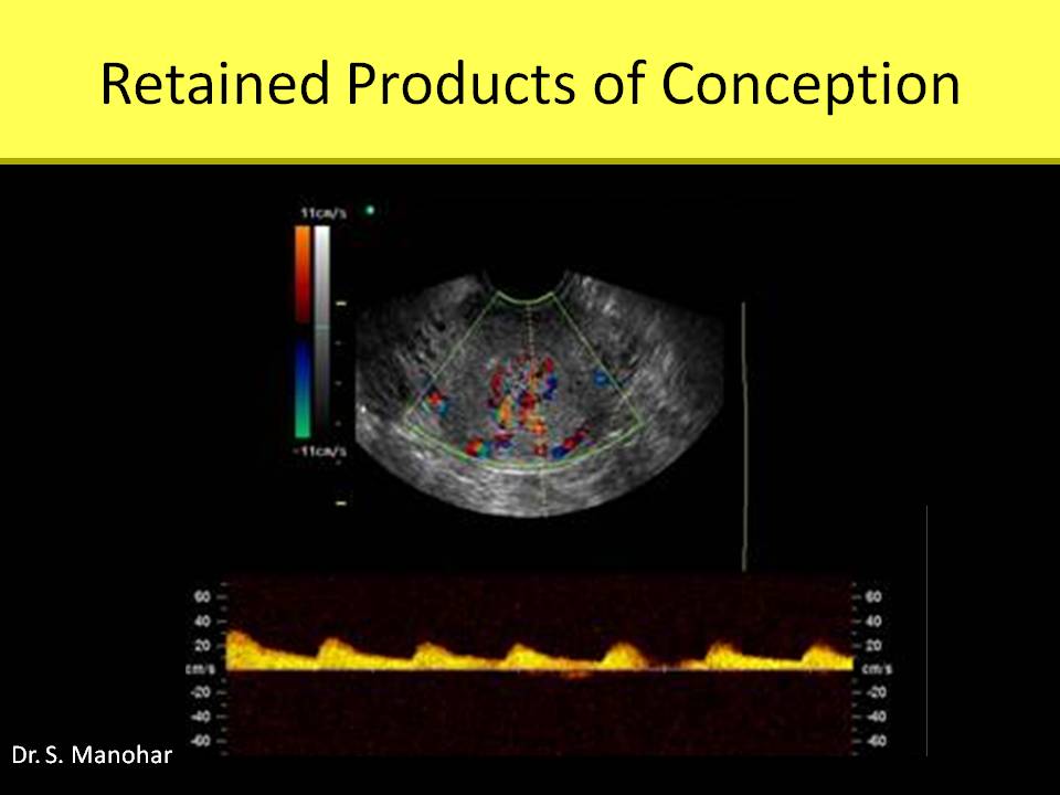 OB GYN sonography