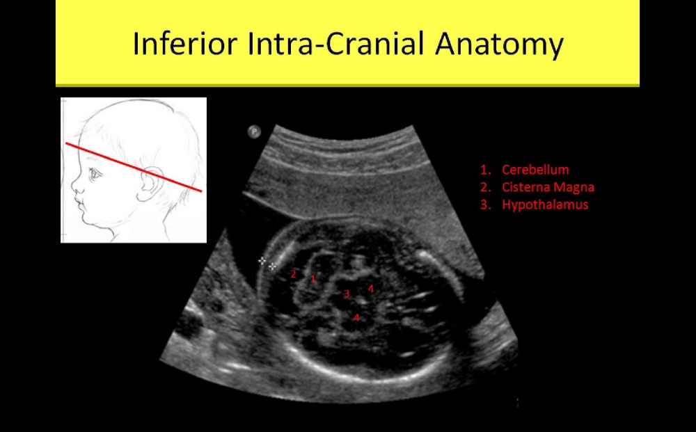 Slide Show Image 9