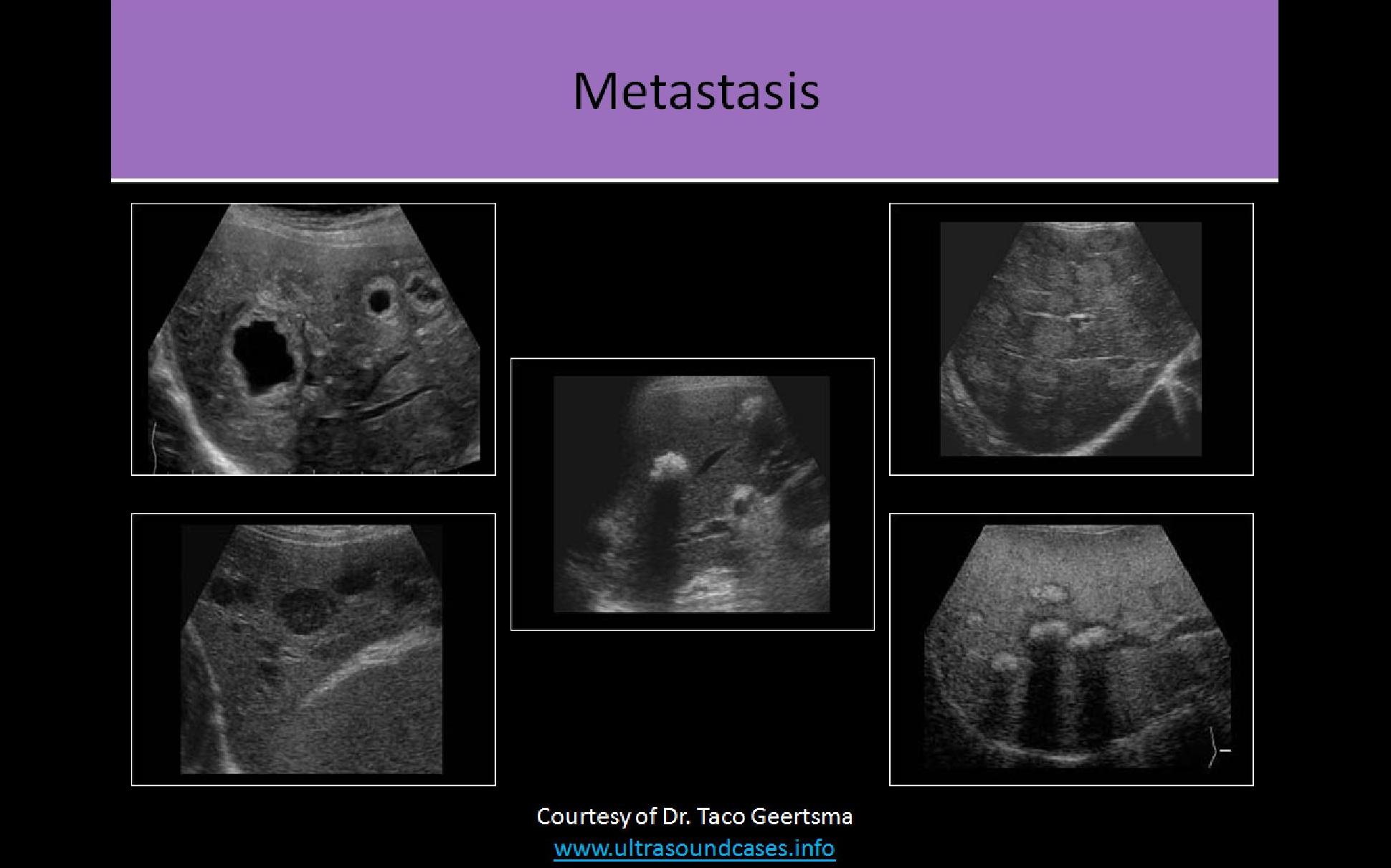 Slide Show Image 1