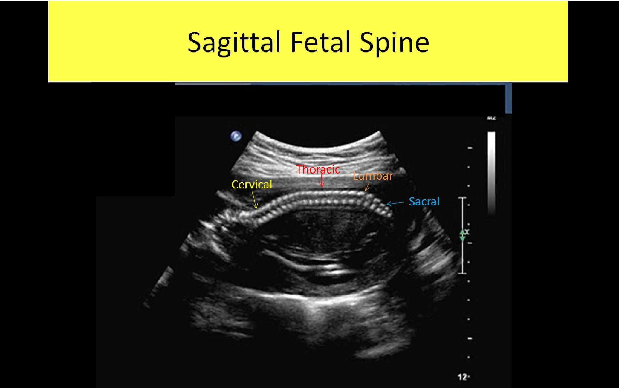Slide Show Image 1