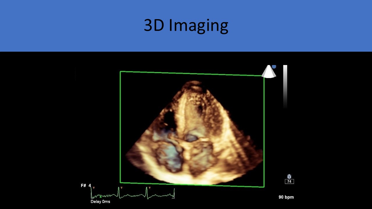 Cardiac Echo Advanced