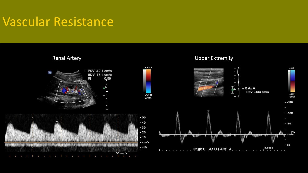 Physics ultrasound image 5