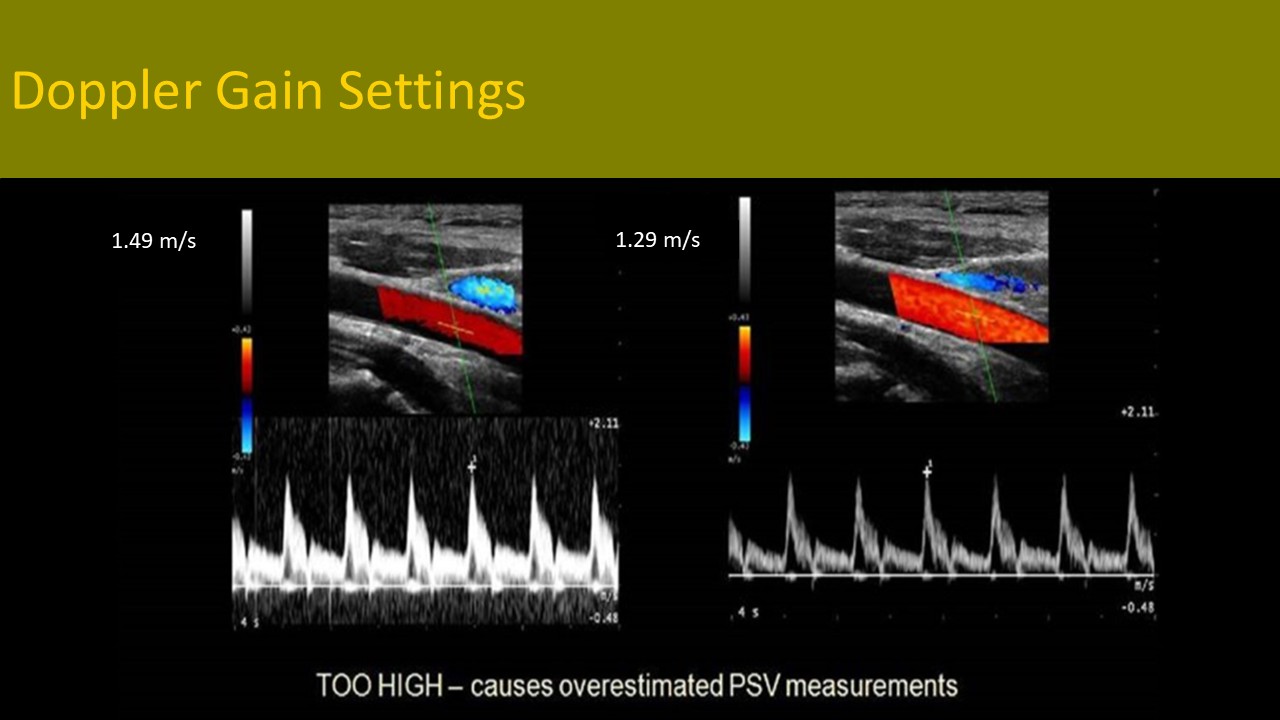 Physics ultrasound image 2