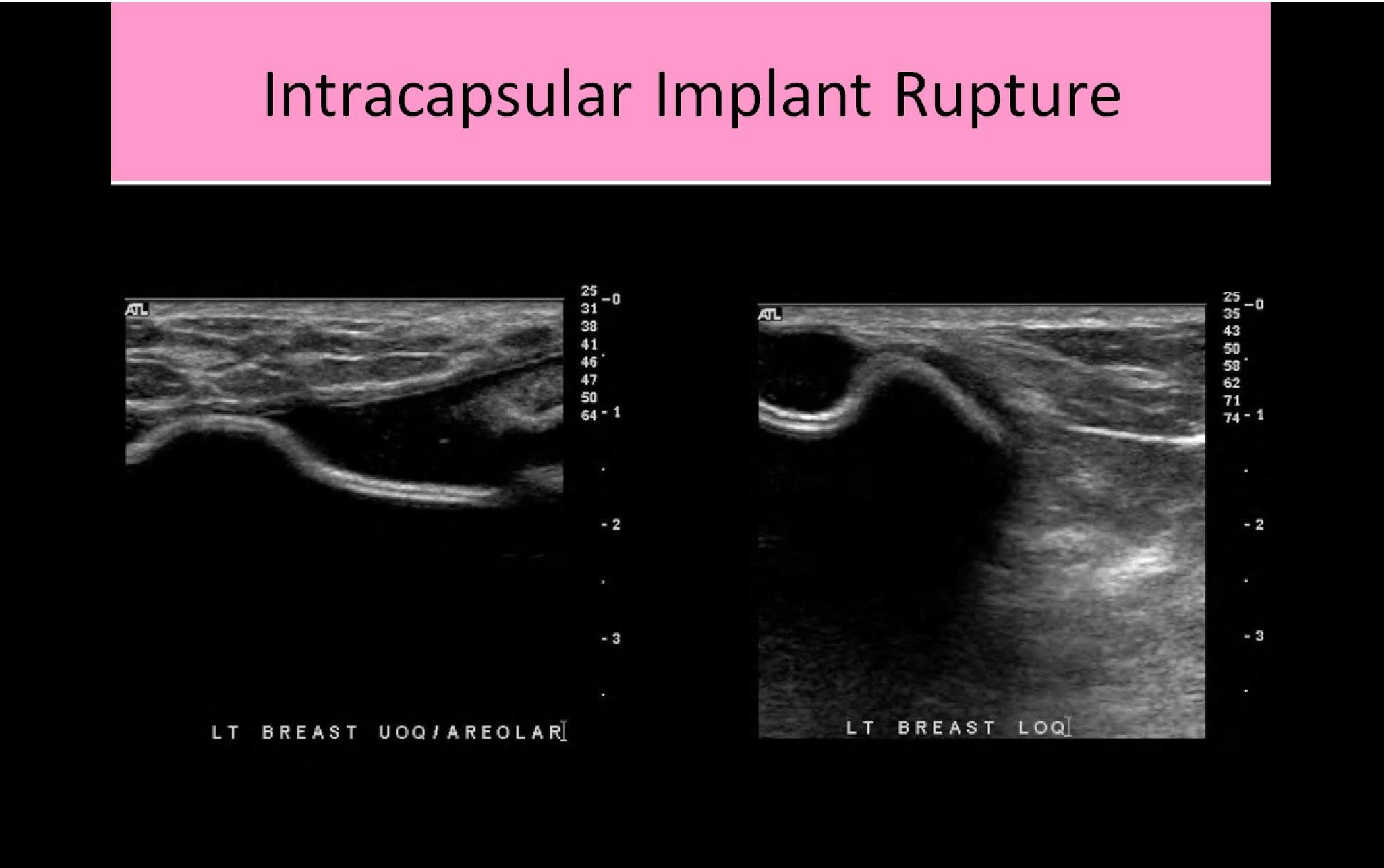 Slide Show Image 5
