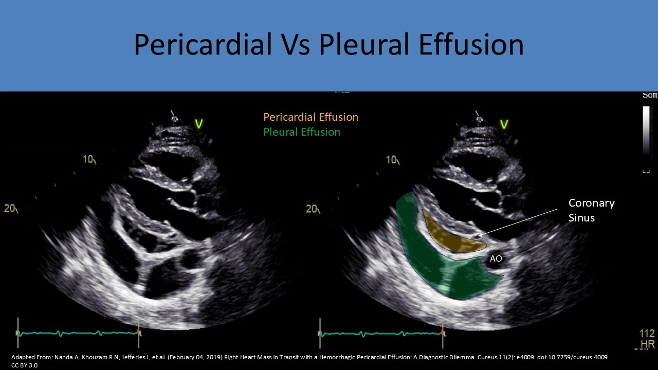 Adult echocardiography image 2