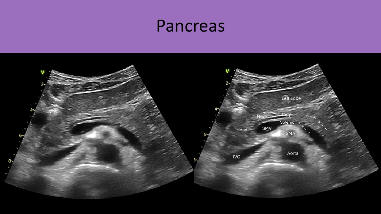 Abdominal ultrasound image 2