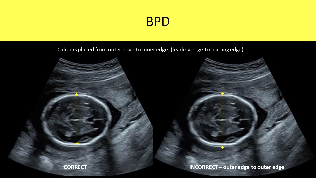 OB GYN ultrasound image 1
