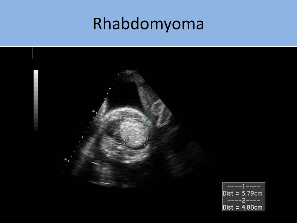 Slide Show Image 1