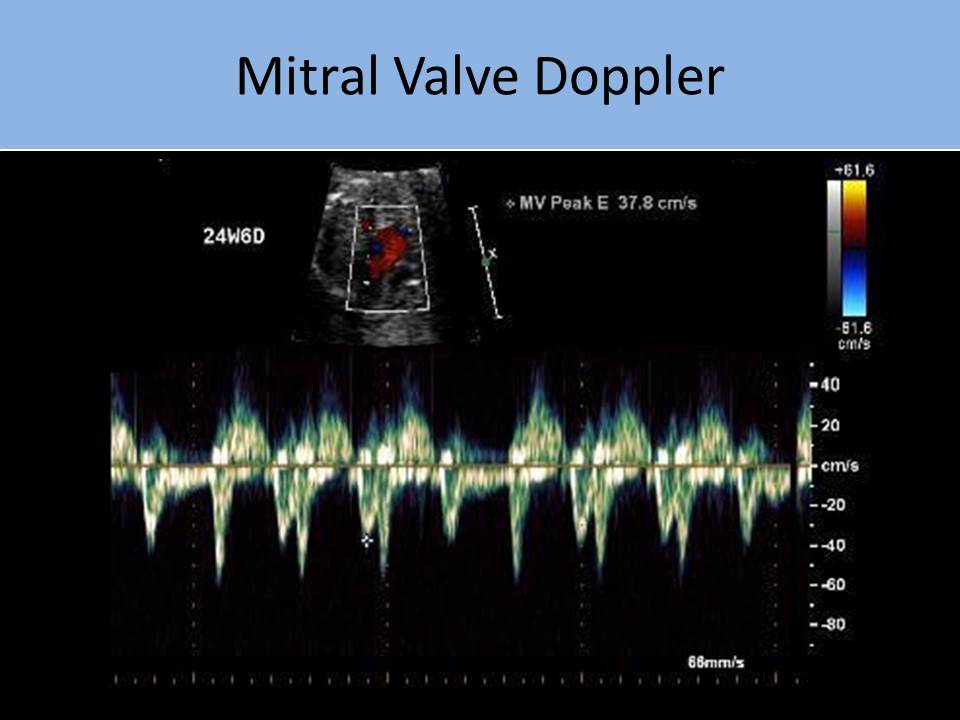 Slide Show Image 2