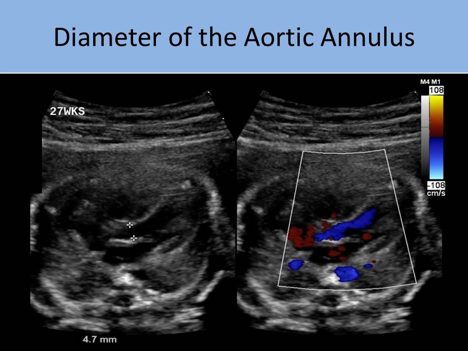 Slide Show Image 3