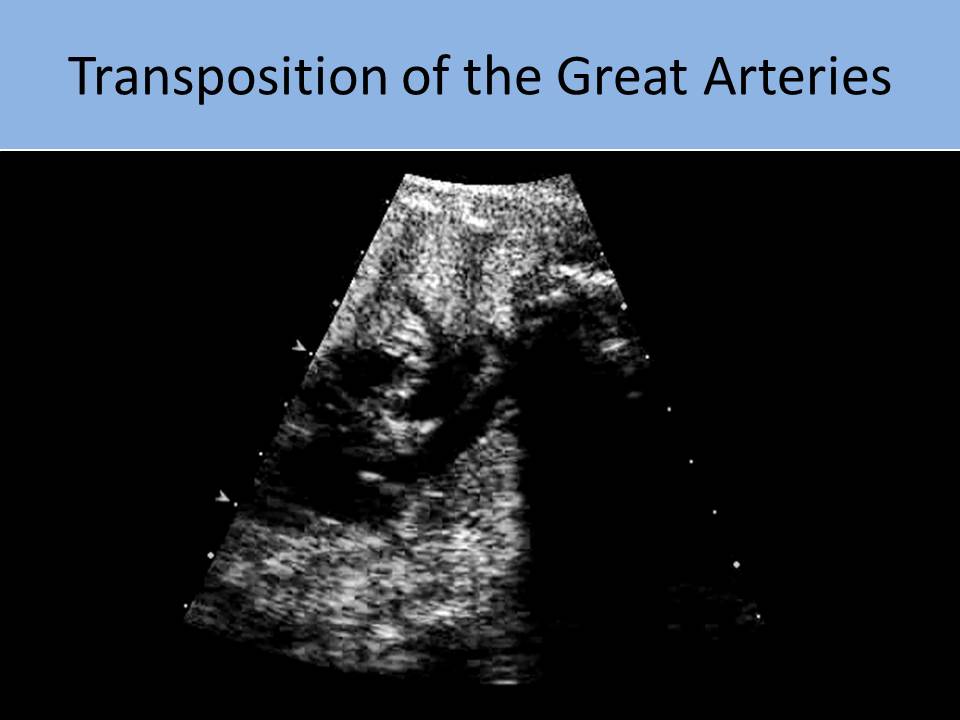 Slide Show Image 6