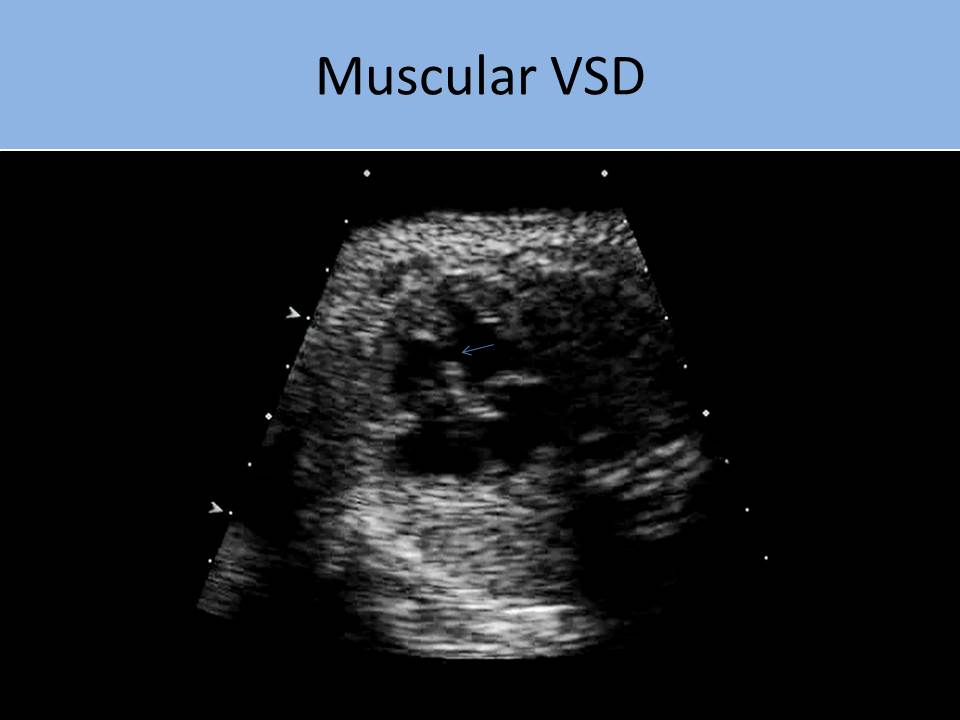 Slide Show Image 7