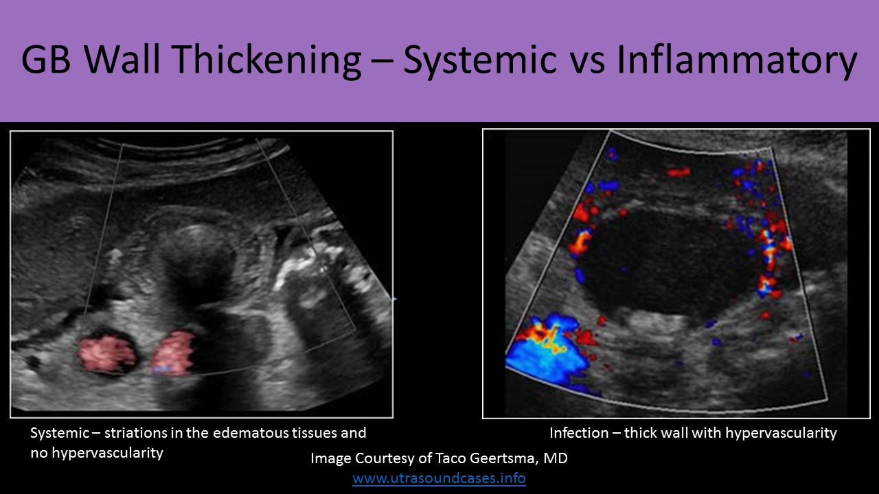 Abdominal ultrasound image 6