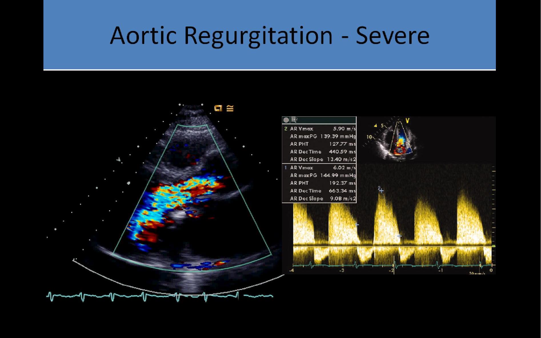 Slide Show Image 1