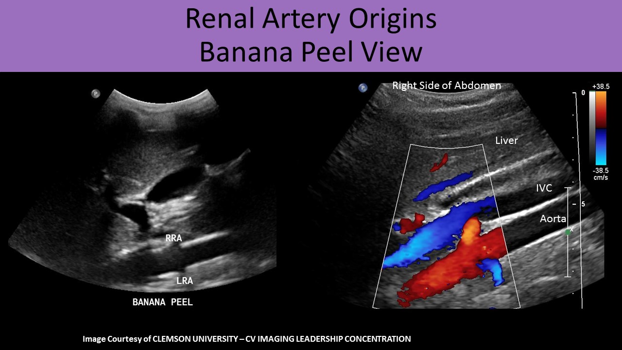 Abdominal ultrasound image 1