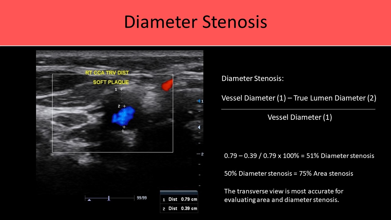 Vascular ultrasound image 1