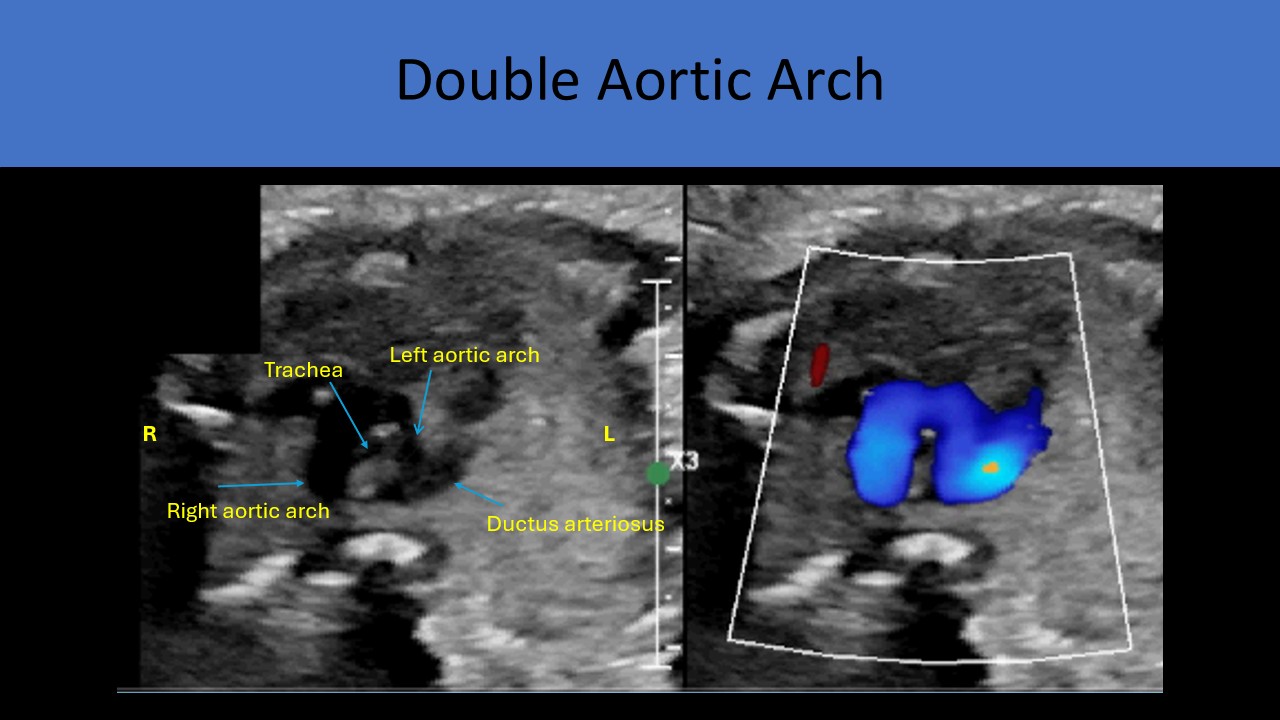 Ultrasound registry review sample image 14