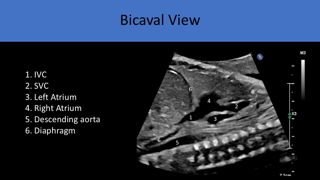 Ultrasound registry review sample image 2