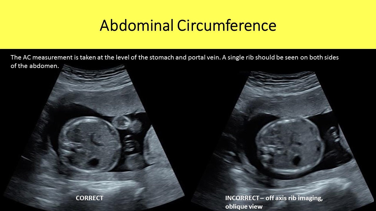 Ultrasound registry review sample image 9