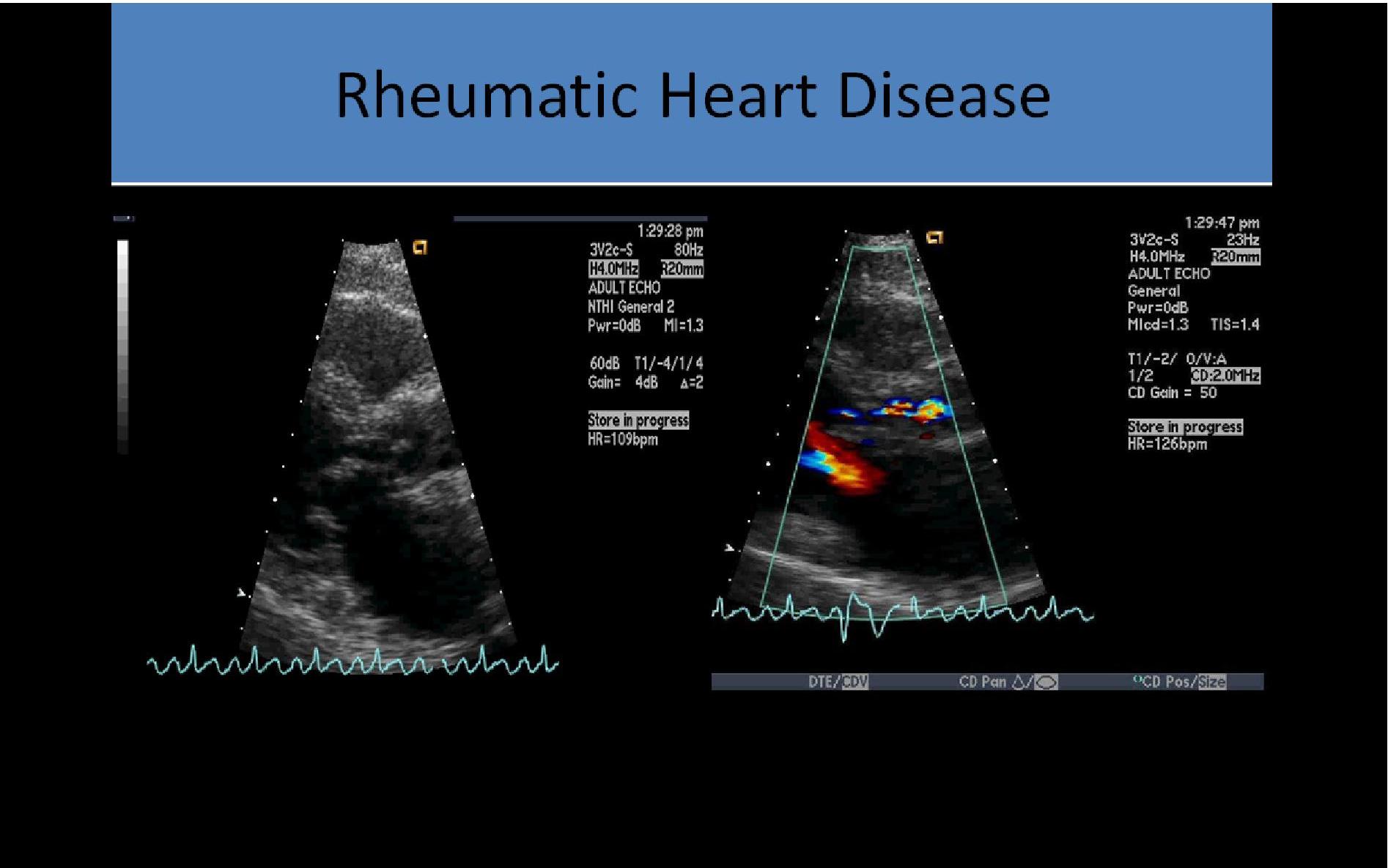 Ultrasound Registry Review - Valvular Abnormalities