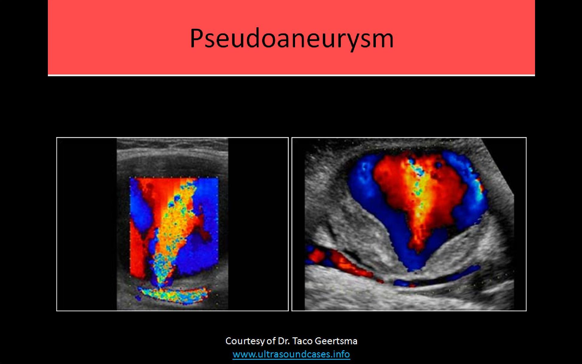Slide Show Image 4