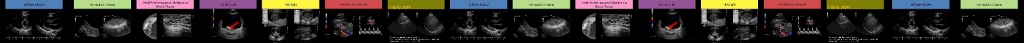 Ultrasound Image Runner