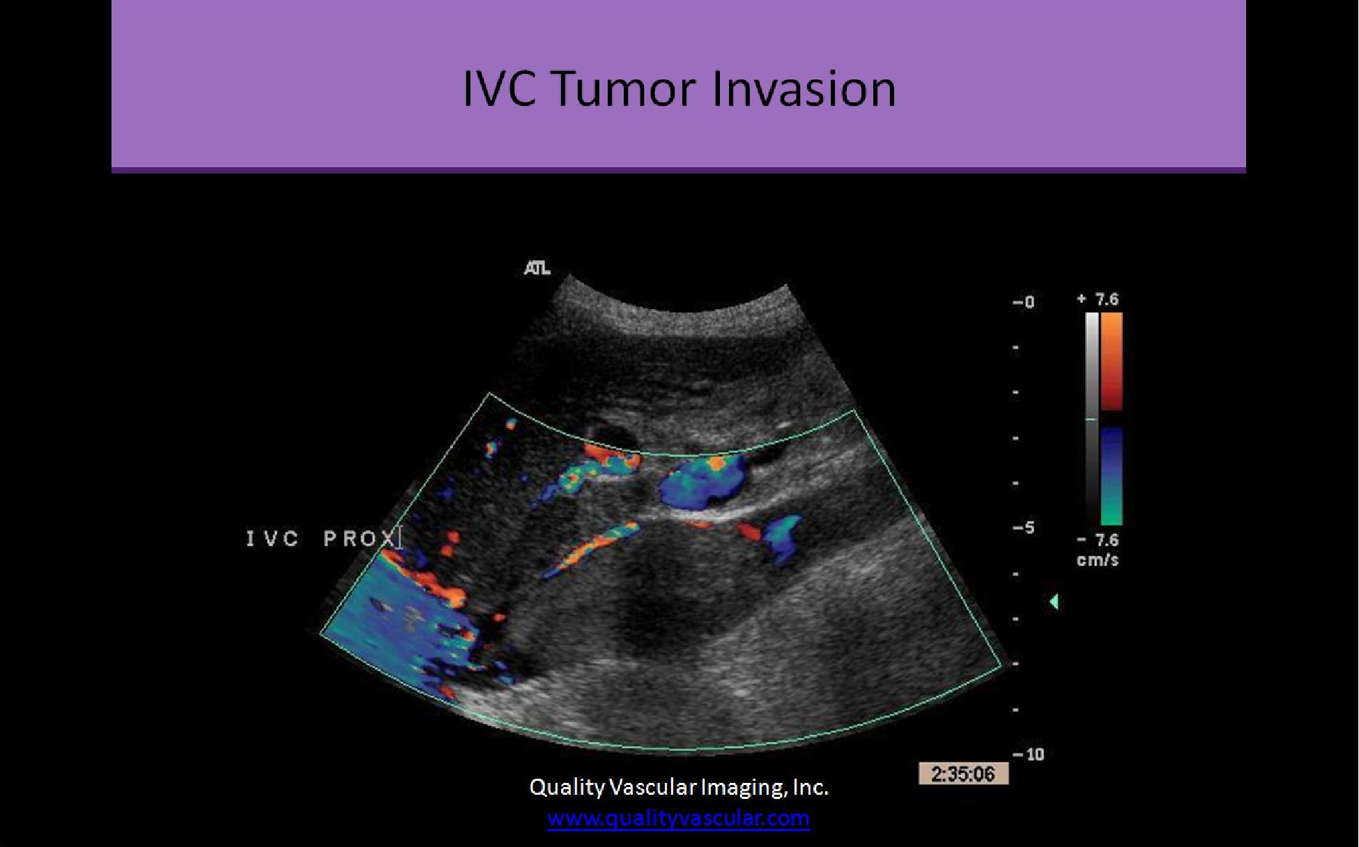 Slide Show Image 4
