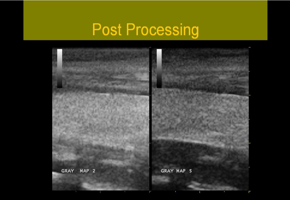 Physics Ultrasound Courses