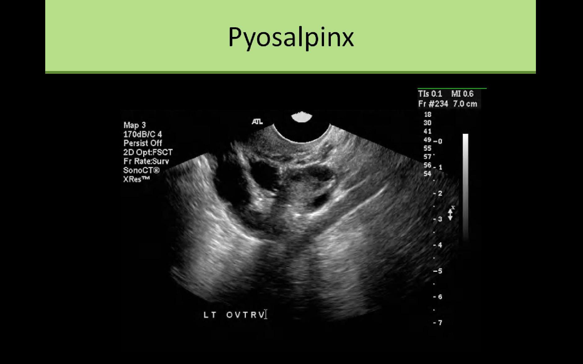 Slide Show Image 5