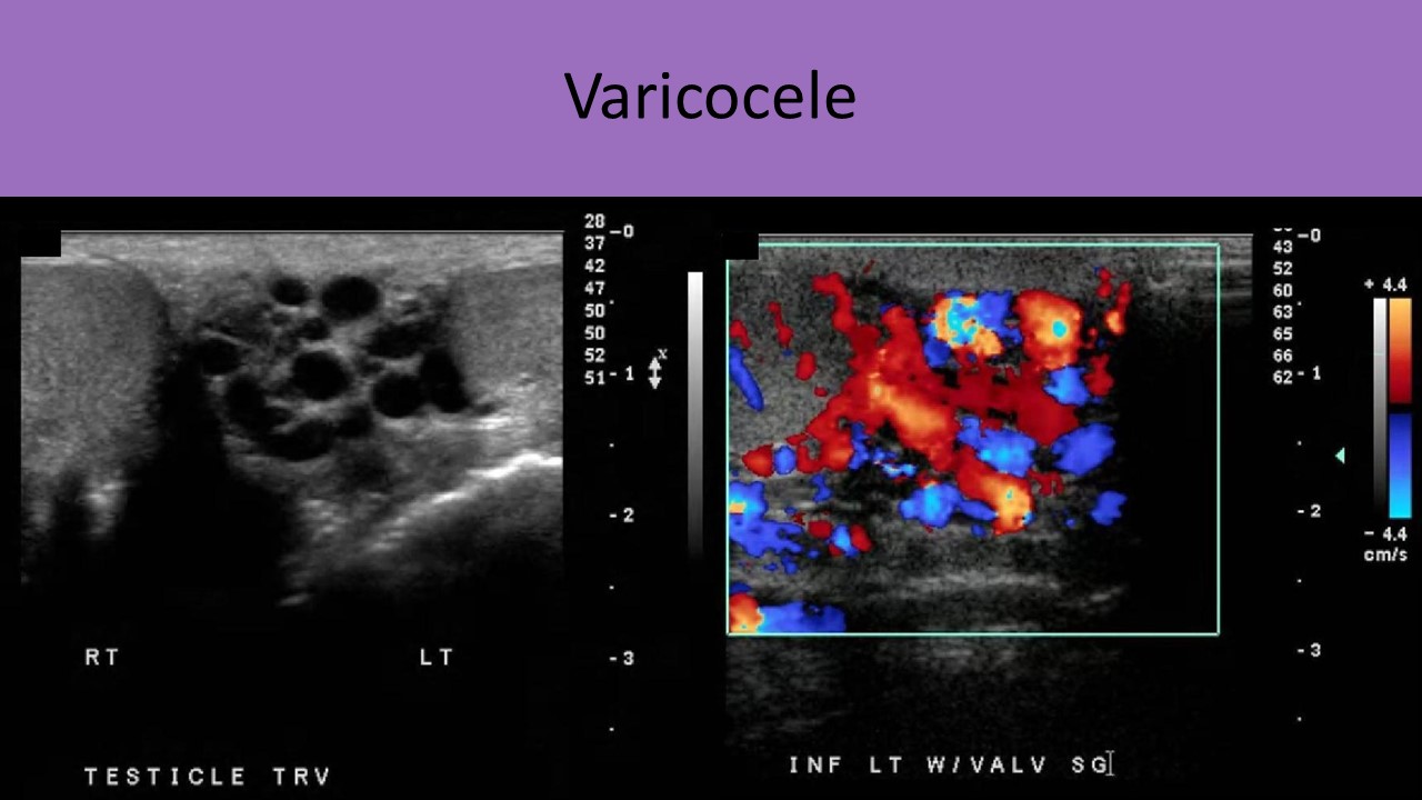 Abdominal ultrasound image 3