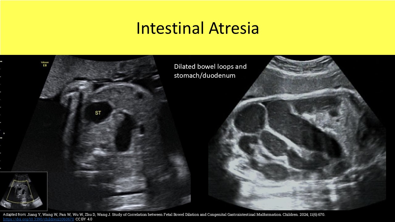 OB GYN ultrasound image 3