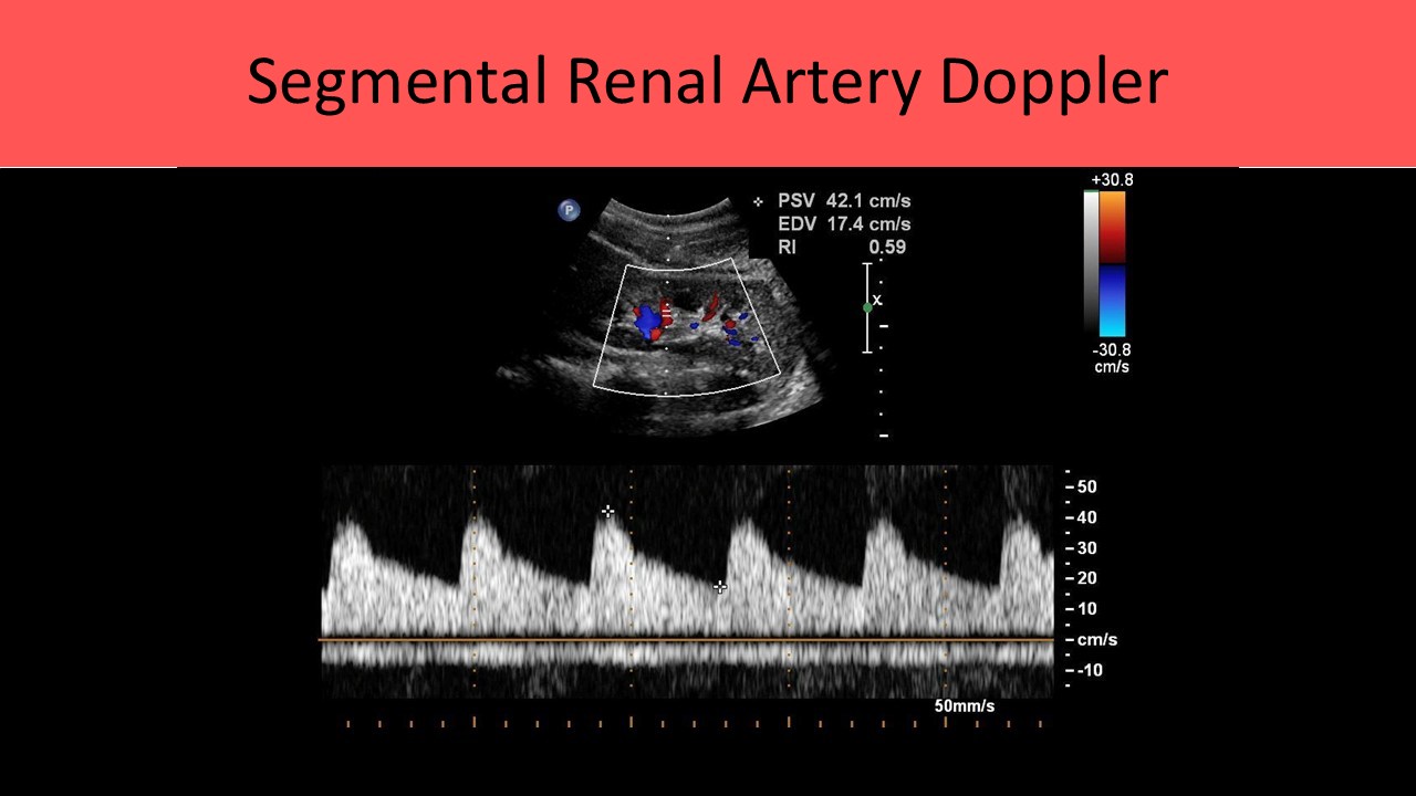 Vascular ultrasound image 4