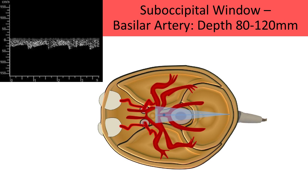 Vascular ultrasound image 6