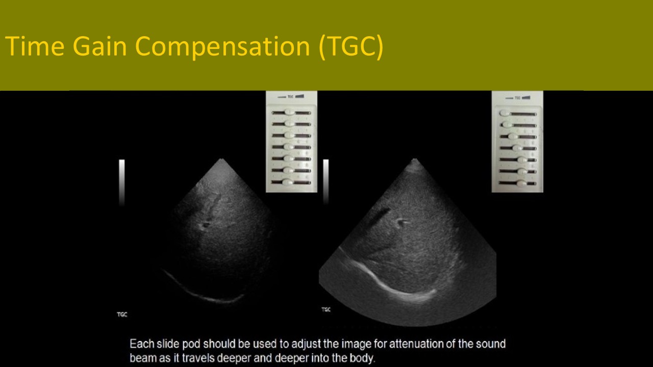 Physics ultrasound image 3