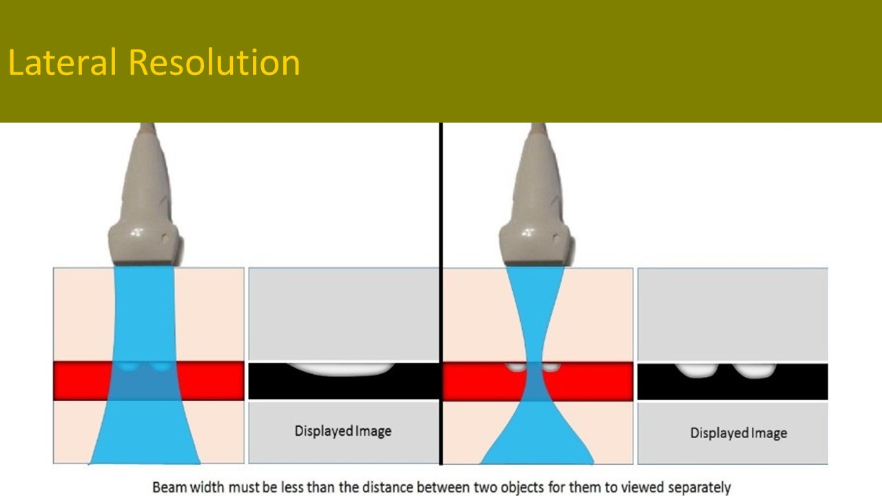 Physics ultrasound image 4