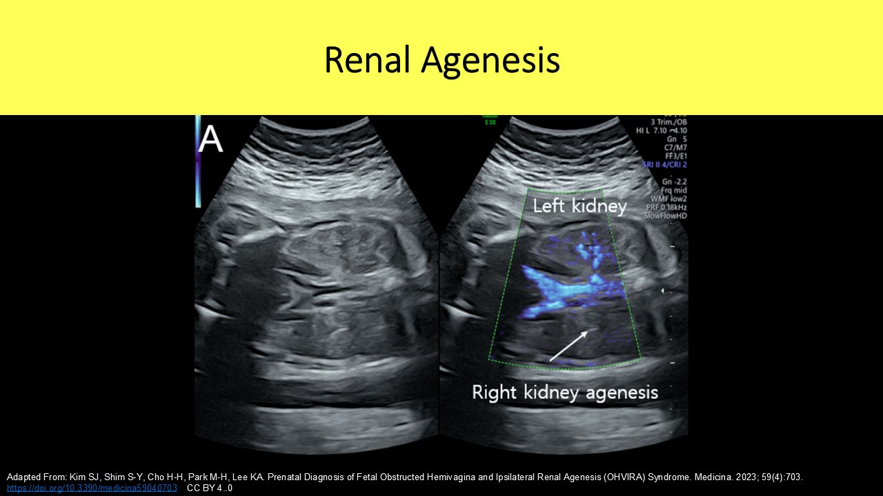 OB GYN ultrasound image 7