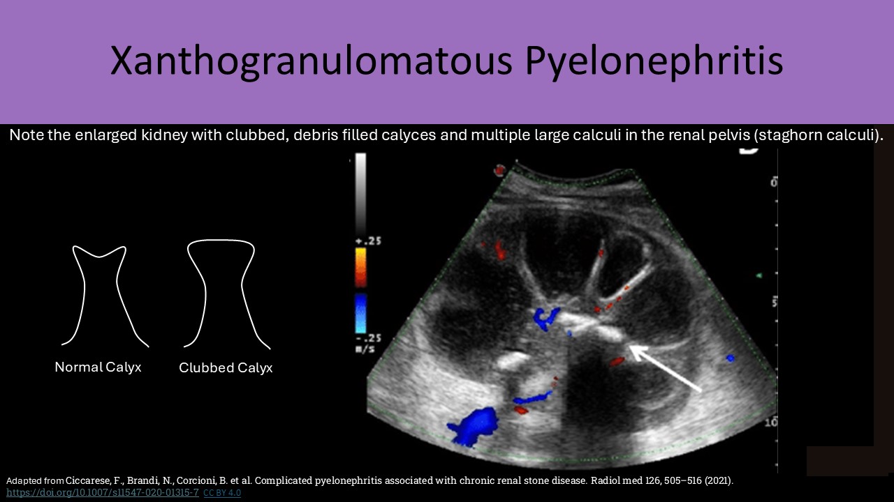 Abdominal ultrasound image 7