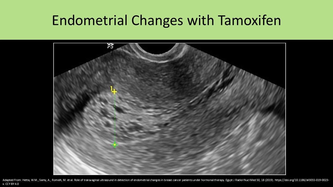 OB GYN ultrasound image 6