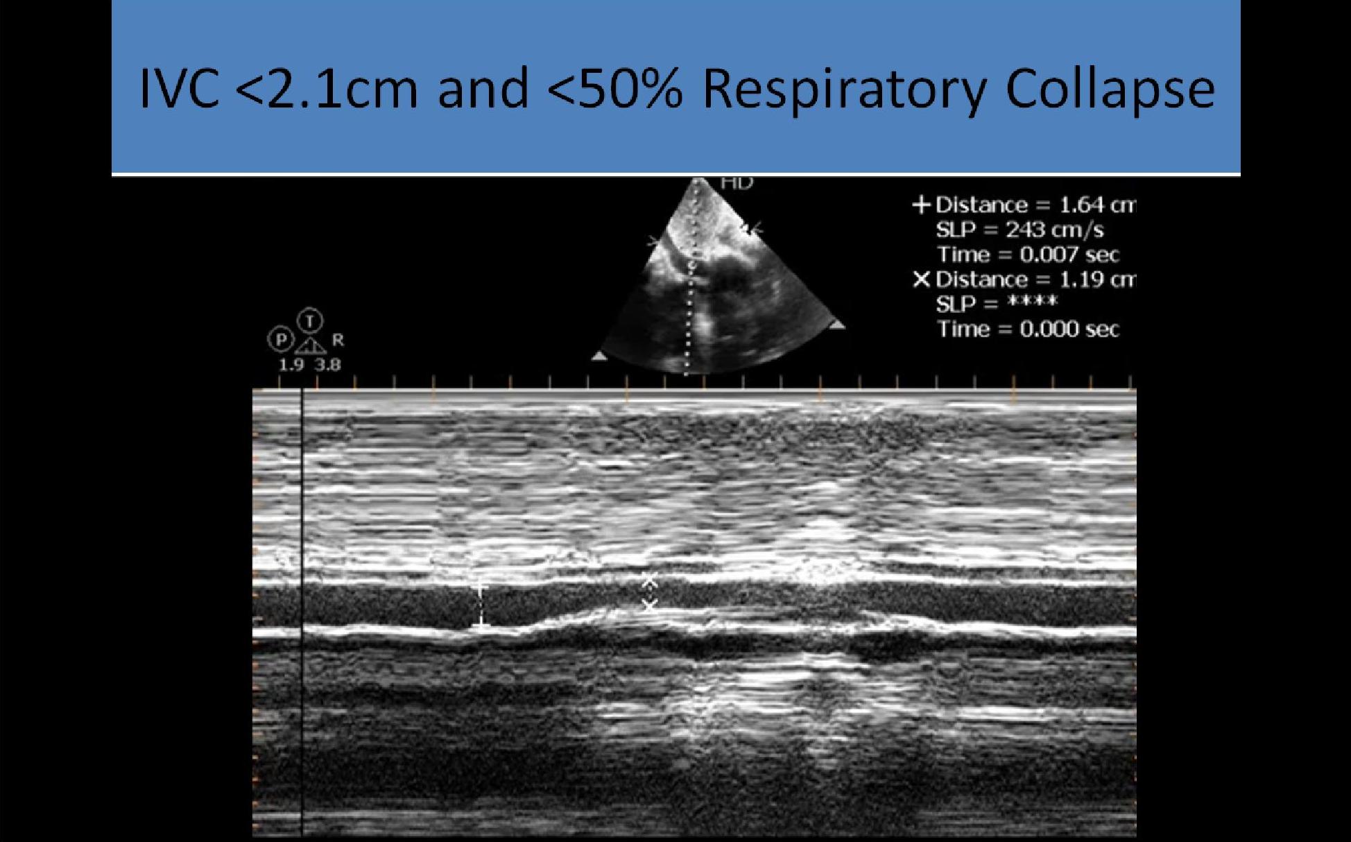 Slide Show Image 3