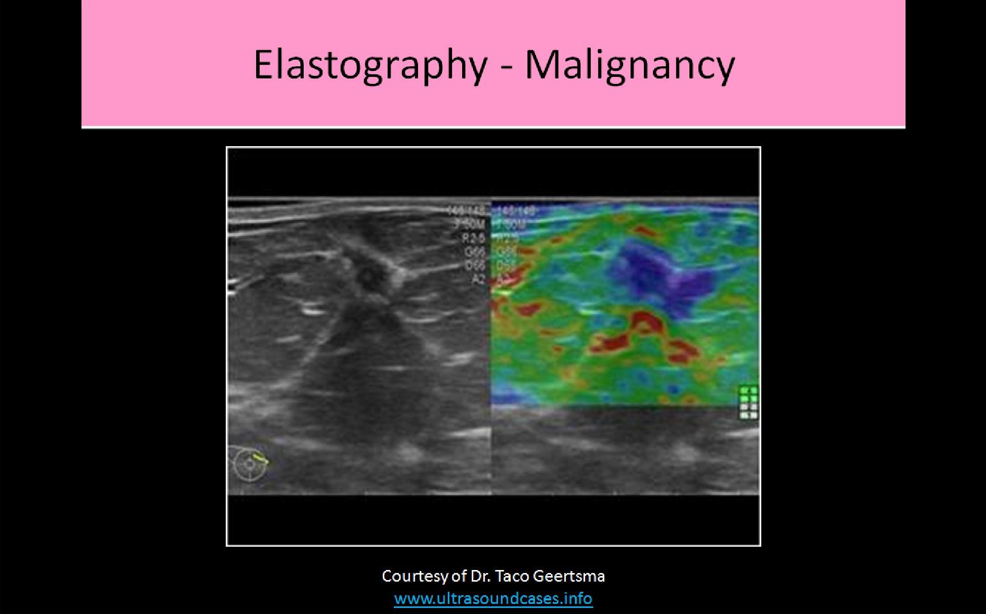Slide Show Image 6