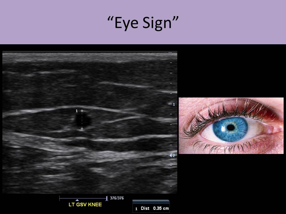 Vascular Ultrasound Courses