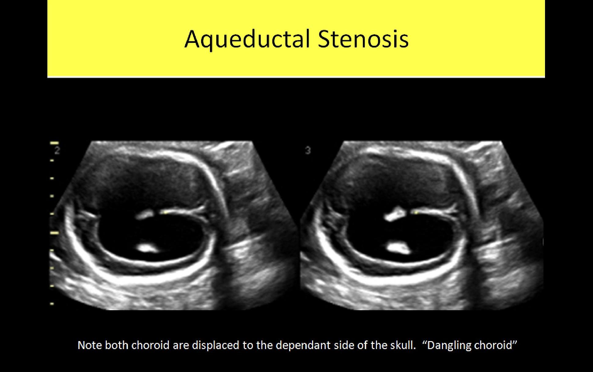 Slide Show Image 6